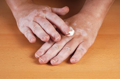 Topical Applications